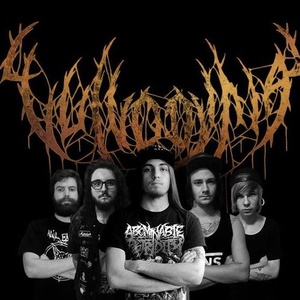 Vulvodynia 2025 Concerts de rock à Vulvodynia